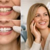 Før og etter Invisalign-behandling