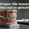 Professional header image for educational tutorial: Attrisjon: Når tennene slites ned av gnissing